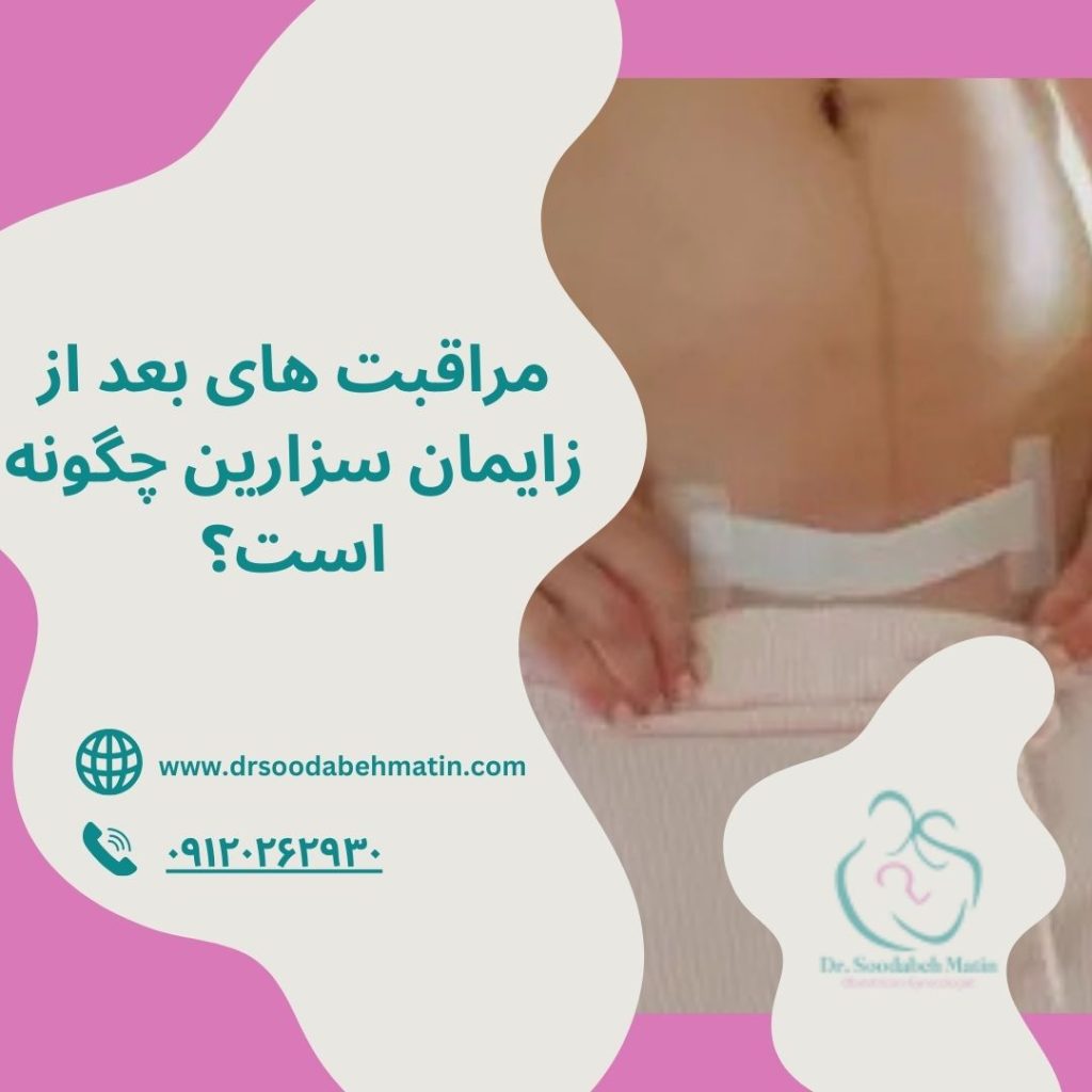 مراقبت های بعد از زایمان سزارین