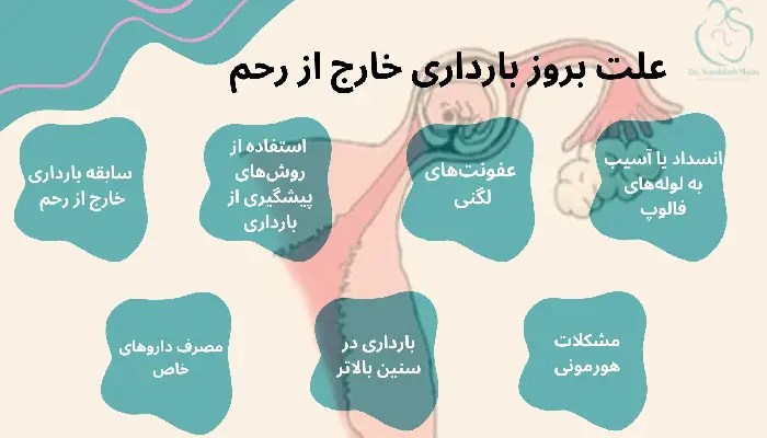 بارداری خارج از رحم