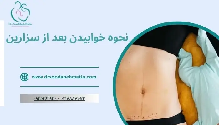 نحوه خوابیدن بعد از سزارین