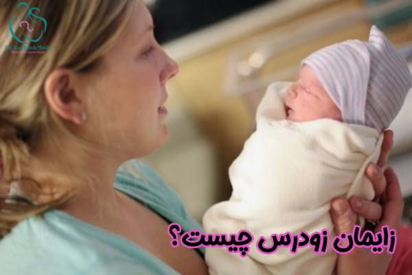 زایمان زودرس چیست