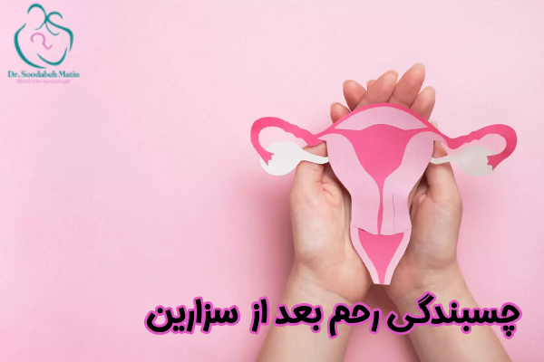 چسبندگی رحم بعد از سزارین چیست