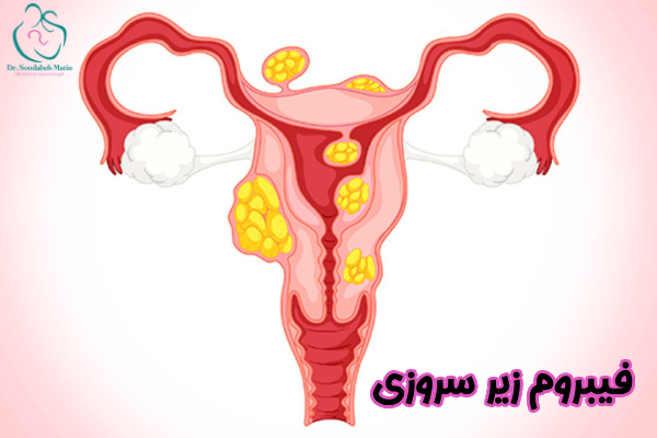 فیبروم زیر سروزی