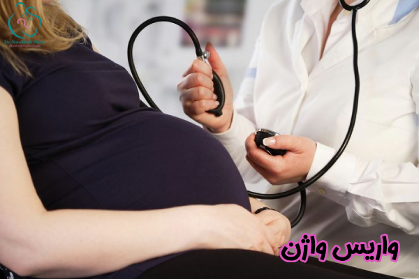 واریس واژن