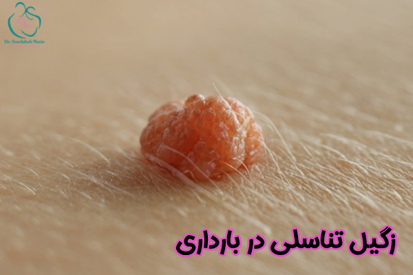 زگیل تناسلی در بارداری چیست