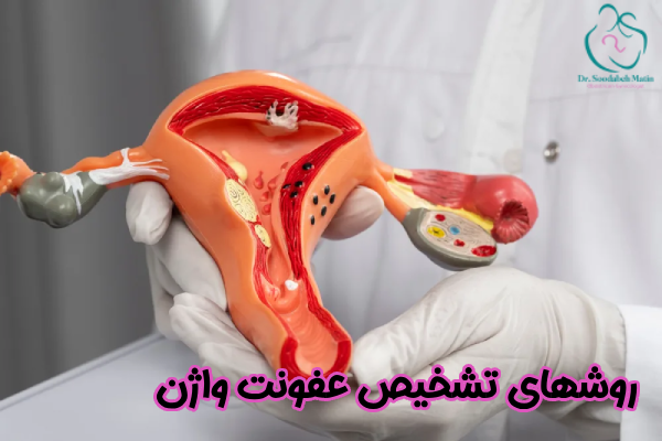 روشهای تشخیص عفونت واژن