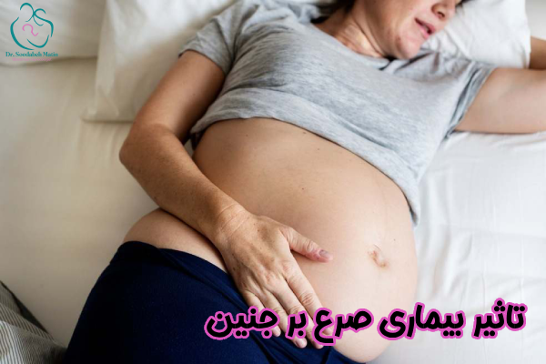 تاثیر بیماری صرع بر جنین