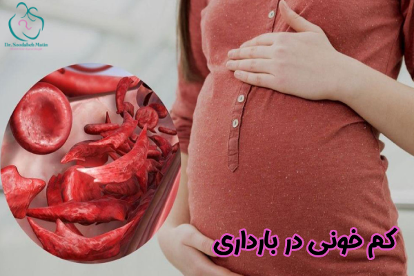 کم خونی در بارداری چیست