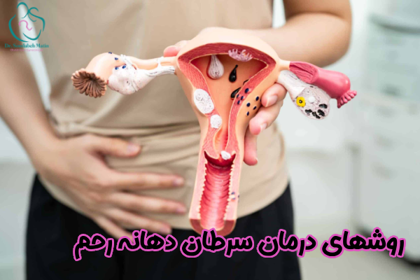 روشهای درمان سرطان دهانه رحم