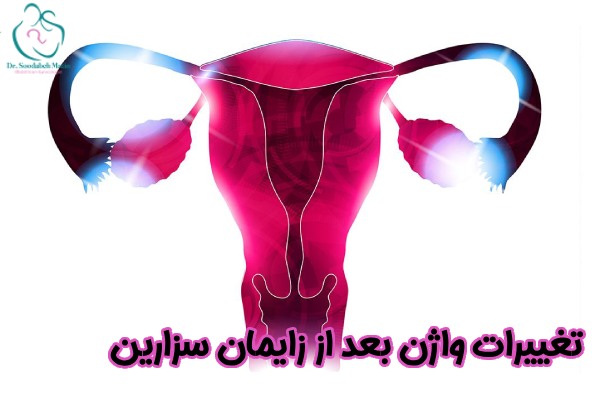 تغییرات واژن بعد از زایمان سزارین