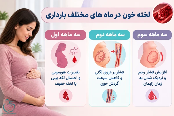 لخته خون در ماه های بارداری